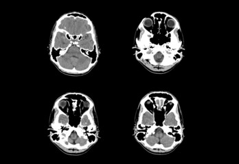 Brain ct scan and MRI professional images