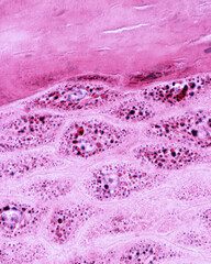 Epidermis. Granular layer