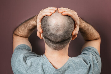 Self-doubt and inferiority complex. Baldy adult man grabs his head with his hands. Rear view. Brown...