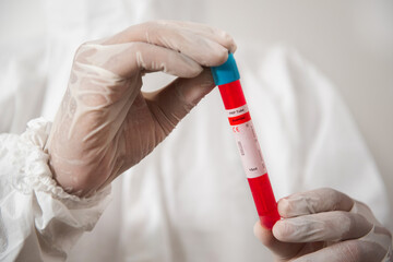 Scientists hold test tubes for analysis. Experiments with red liquid chemicals.