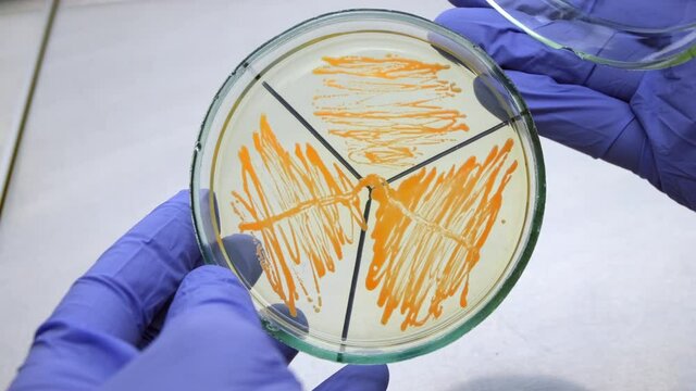 The scientist opens a petri dish with separately grown orange-colored bacteria, examines the bacterium in a sterile laminar flow cabinet and closes the dish, close-up.