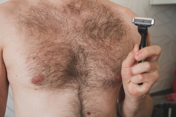 Strong growth of hair on the body of a man. Removal of excess hair from the body of a man. The problem of excess body hair. Excess hair on a man's chest