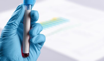 COVID-19 detected result, laboratory report of COVID-19 testing and doctor hand