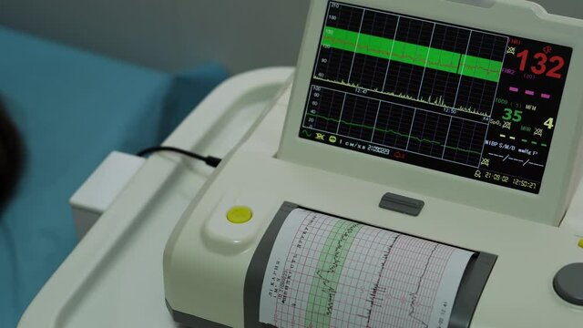 Electronic Cardiotocography Machine Monitoring Fetal Heart Contractions Of Uterus. Printing Cardiogram Report Coming Out Electrocardiogram In Labor Ward During Pregnancy. Medical Diagnostic Equipment