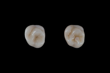 Dental crown of chewing tooth made of high quality ceramic on a black background.