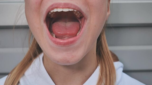 The young girl opens her mouth and shows her tongue. Stamatology theme.