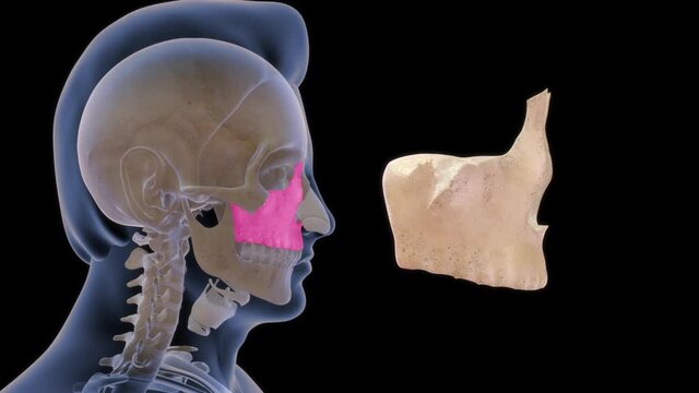 The maxilla is the bone that forms your upper jaw. The right and left halves of the maxilla are irregularly shaped bones that fuse together in the middle of the skull, below the nose