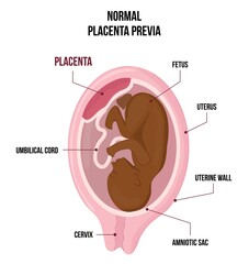 Obraz premium Normal Previa black