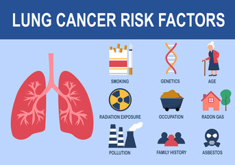 Lung cancer risk factors infographic vector illustration.