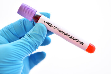 Obraz premium Test tube with blood sample for COVID-19 neutralizing antibody
