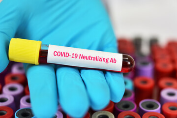 Test tube with blood sample for COVID-19 neutralizing antibody