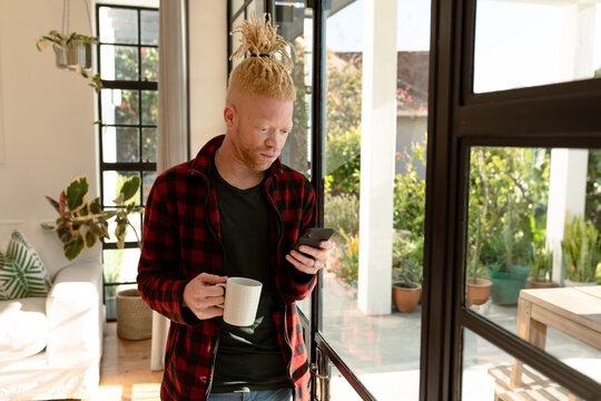 Thoughtful albino african american man with dreadlocks using smartphone and drinking coffee - Powered by Adobe