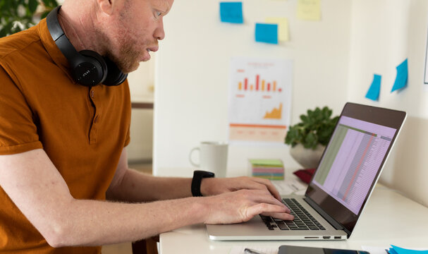 Albino african american man with dreadlocks working from home and using laptop