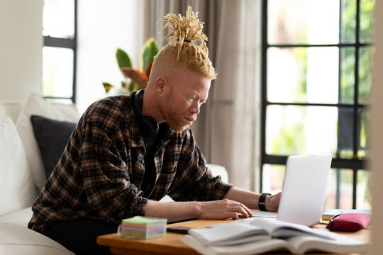 Albino african american man with dreadlocks working from home and using laptop