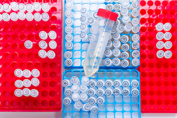Top-down view of different trays of test tubes with big measuring vessel in medical laboratory