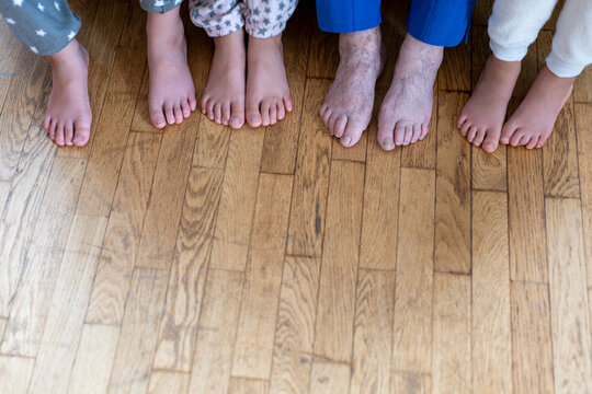 Several pairs of bare feet of people of different ages. Children and grandmothers with sore feet