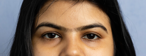 human eyebrow - unibrow