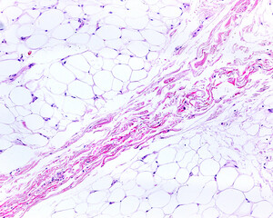 Subcutaneous adipose tissue. Blood vessels - obrazy, fototapety, plakaty