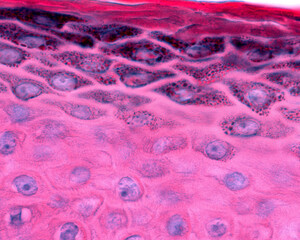 Epidermis. Granular layer