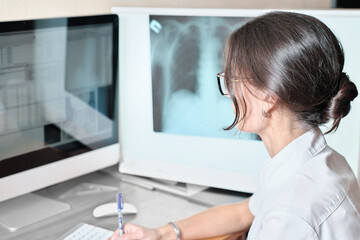 Young asian woman radiologist doctor analysis pulmonary x-ray and make a medical description of...