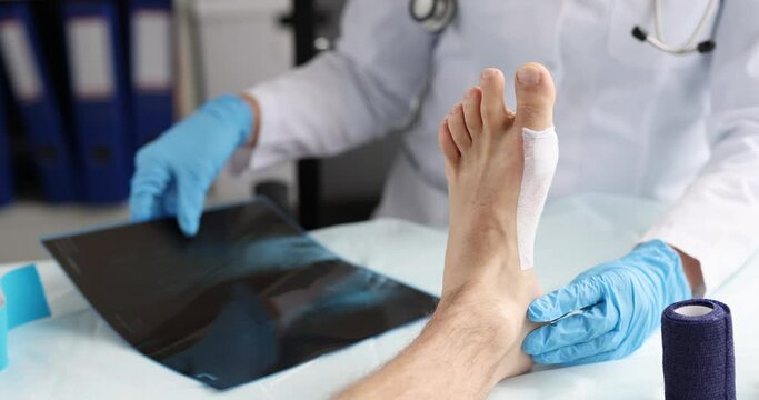Doctor traumatologist looking at xray of foot in front of patient sore leg 4k movie