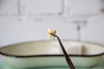 Dentist shows the extracted tooth in tweezers