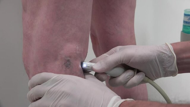 Ultrasonography of Lower Extremity Varicose Veins.