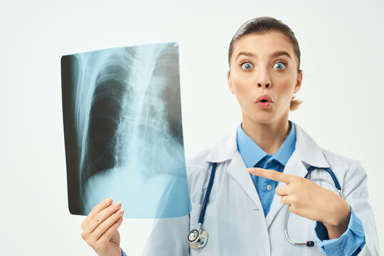 surprised radiologist showing x-ray emotion light background