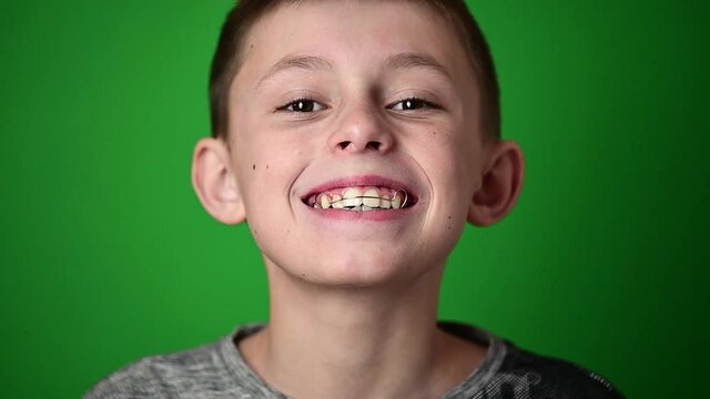 Smile baby, boy wears a plate for aligning teeth, dental care.