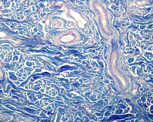 Thick skin dermis. Dermis reticular of the thick skin, stained with the Cajal-Gallego’s method....