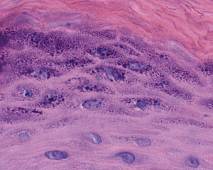 Epidermis. Granular layer