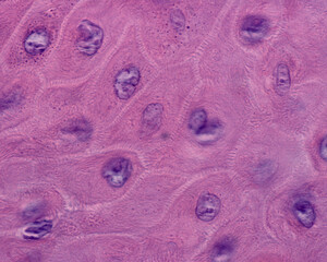 Epidermis. Spinous layer