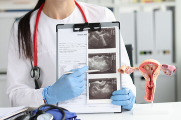 Gynecologist shows ultrasound of uterus in office closeup
