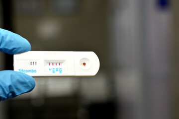 Positive result of HIV AIDS, HCV and positive HBV in a rapid test cassette kit for Hepatitis C virus antibodies HCV AB, Human Immune virus HIV AIDS test and HBsAG Hepatitis B surface antigen