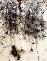 Mouse brain section stained with the Golgi stain, a 19th century technique that was  widely used until recently -  and occasionally still is. Widefield microscopy. Neurons in the cerebral cortex.