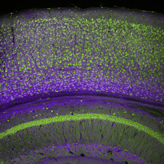 Cerebral cortex and part of the hippocampus under it in a section of a mouse brain, labelled with...