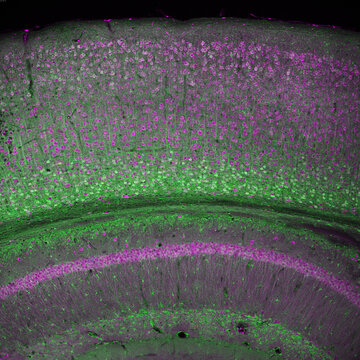 Cerebral cortex and part of the hippocampus under it in a section of a mouse brain, labelled with immunofluorescence and recorded with confocal laser scanning microscopy