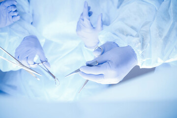 A group of surgeons is operating at the hospital, close-up of hands. Health care concept