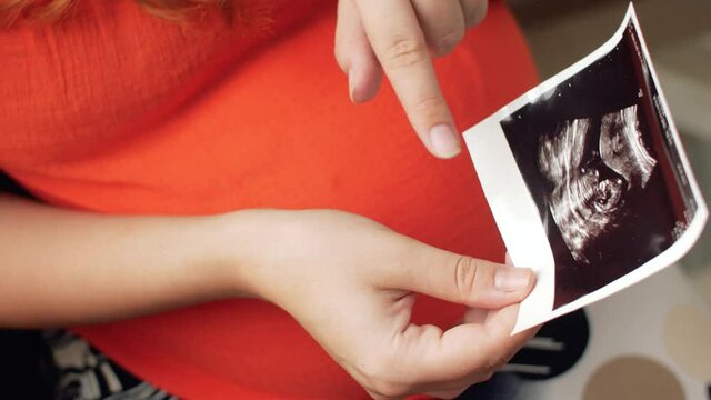 picture of an ultrasound scan in hands of pregnant woman sitting on a sofa in kitchen in company of friend, family relationship