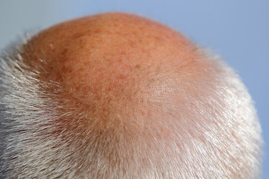 Haut und Haar