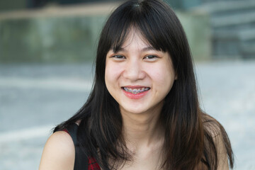 Closeup beautiful smiling girl with dental braces fashion healthy and lifestyle.