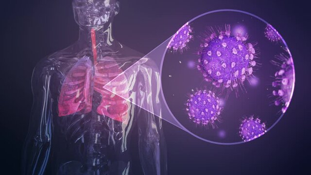 Coronavirus cells inside lungs. Pneumonia. Influenza type virus as dangerous flu. Pandemic medical health risk concept with disease cells inside human body.