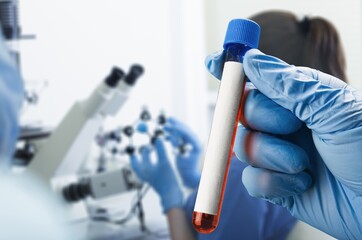 Genetic tests. Laboratory test tube the study of human genetic characteristics. Chromosomal...