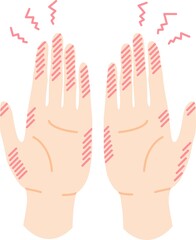 手荒れ しもやけ のイラスト