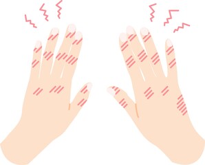 手荒れ しもやけ のイラスト