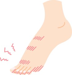 足のしもやけのイラスト