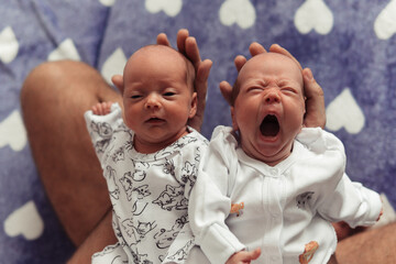 Close-up portrait of newborn twins laying by heads in father's hands. Yawning newborn girl. Cute and tender photo of newborn twin girls. Selective focus. Film grain