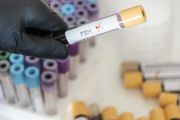 Close-up of positive blood sample from FSH.