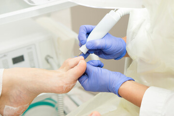 Professional hardware pedicure using electric machine.Patient on medical pedicure procedure, visiting podiatrist.Peeling feet with special electric device.Foot treatment in SPA salon.Podiatry clinic.