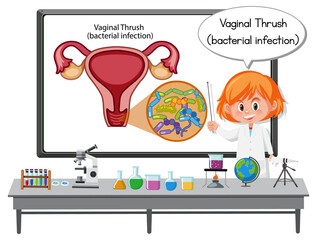 Young doctor explaining vaginal thrush (bacterial infection)
